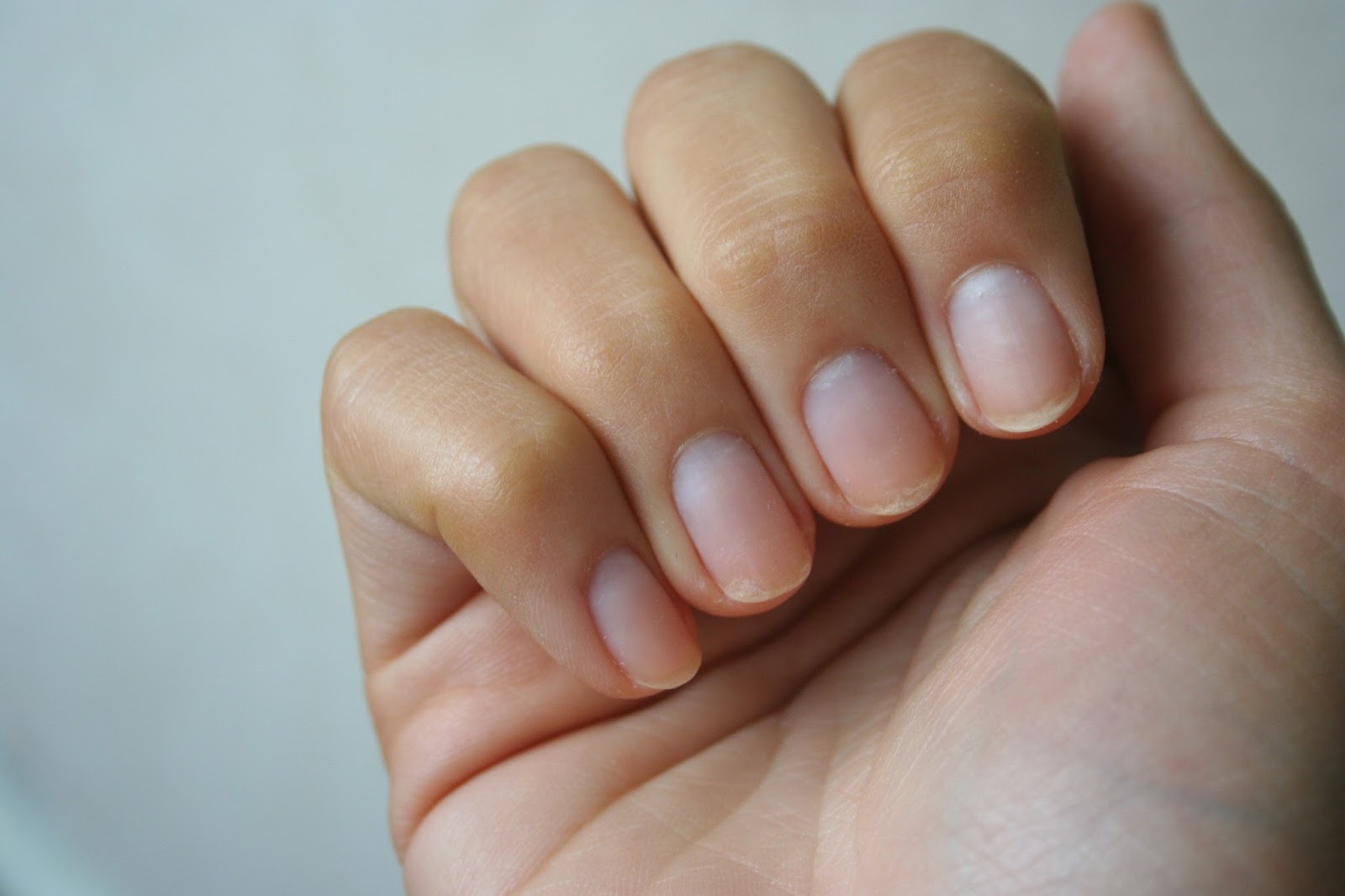 Ногти тонкие мягкие что делать. Бледные ногти на руках. Тонкие ногти. Бледная ногтевая пластина.