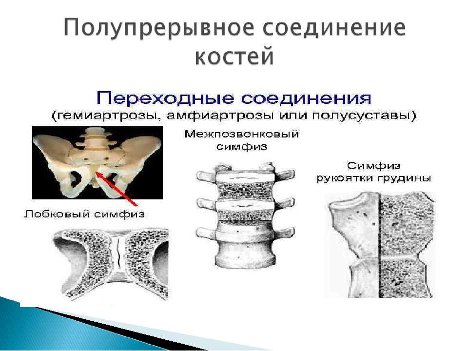 Прерывное соединение кости. Типы соединения костей прерывные непрерывные полупрерывные. Полупрерывное соединение костей примеры. Соединения костей: непрерывные, полупрерывные, суставы. Типы соединения костей.