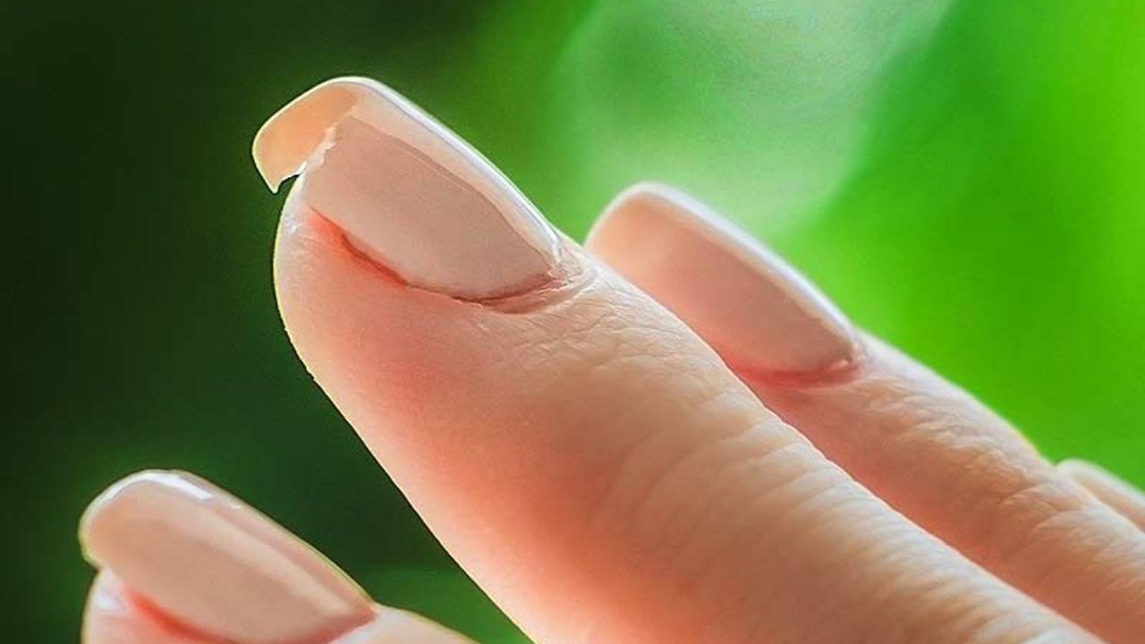 Ногти тонкие мягкие что делать