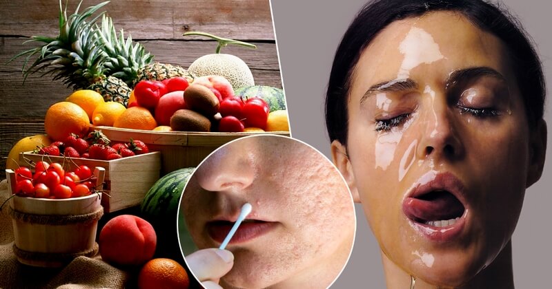 Alimentos malos para el acne