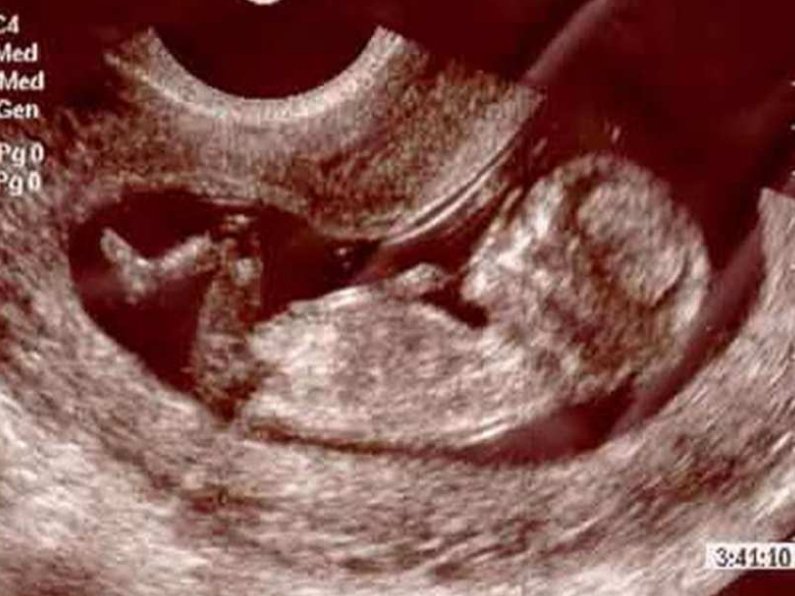 Как выглядит ребенок в 12 недель беременности фото