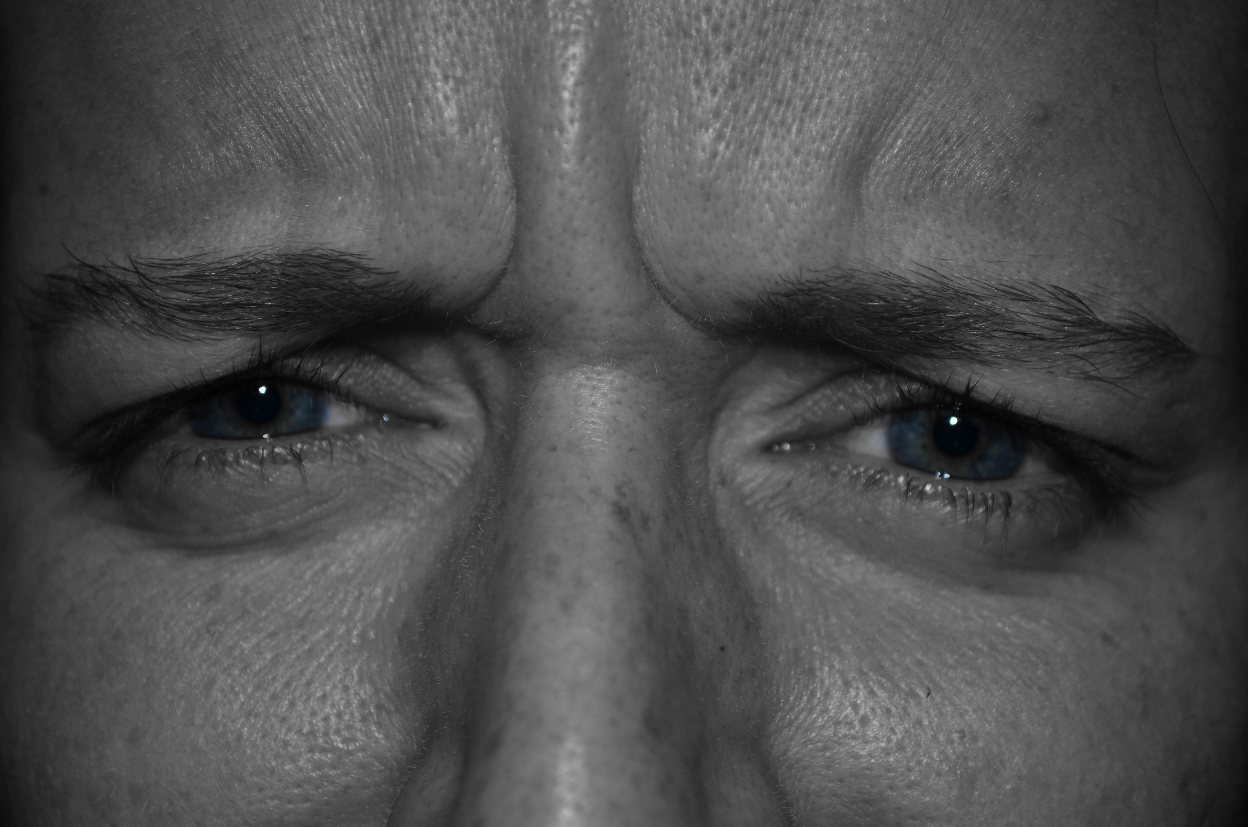 Жизнь с одним глазом. Серьезные глаза. Взгляд человека. Глаза мужские. Серьезный взгляд.