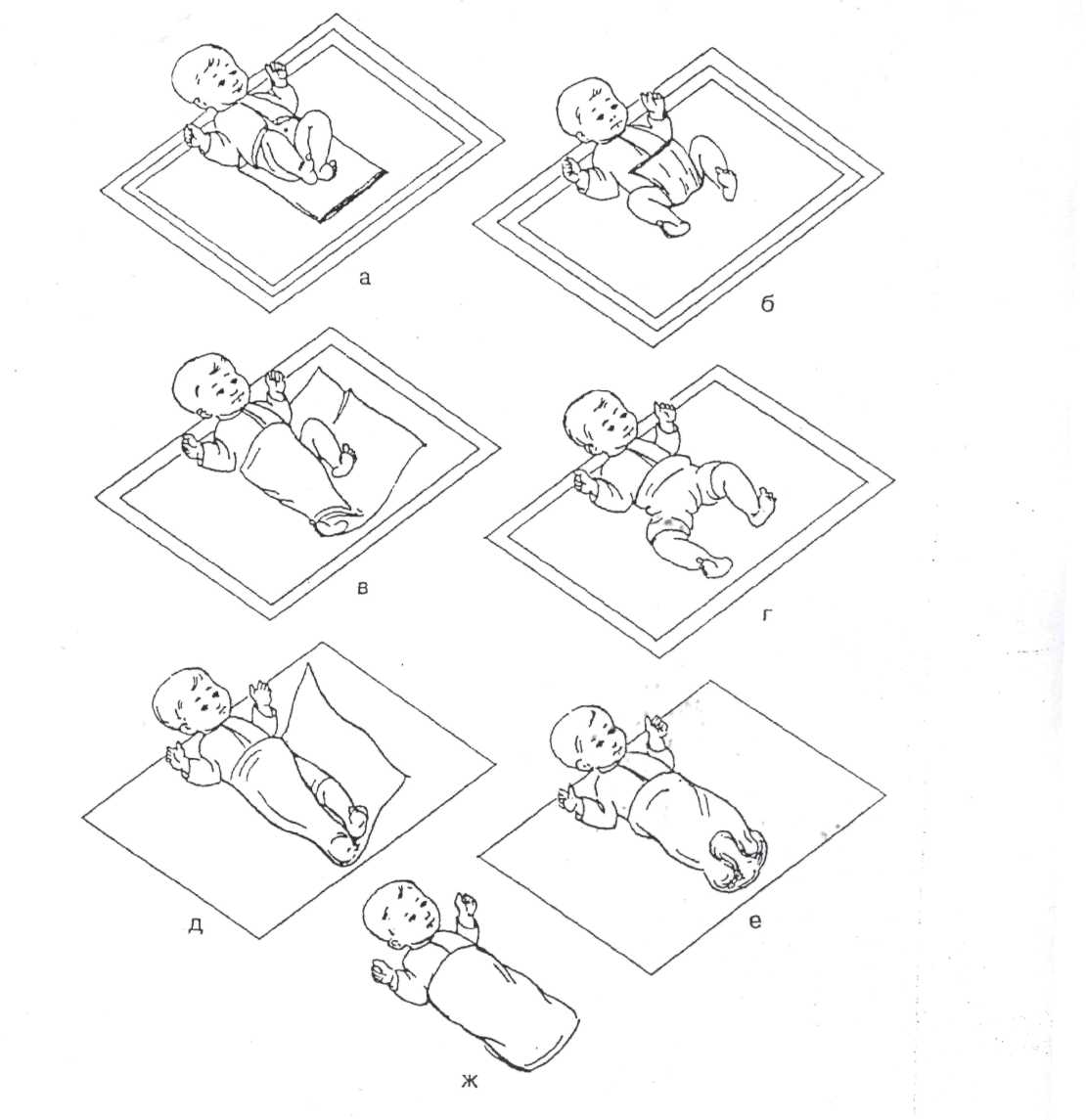 Алгоритмы новорожденных. Широкое пеленание новорожденного алгоритм. Техника широкого пеленания новорожденного алгоритм. Широкое пеленание новорожденного. Широкое пеленание новорожденного закрытый способ.