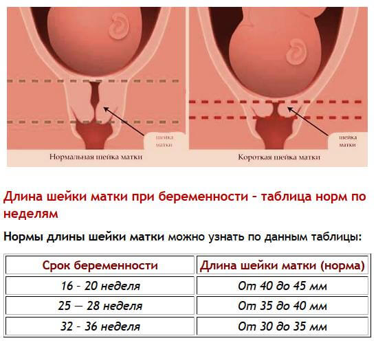 Длина шейки матки фото